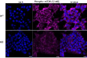 Immunocytochemical staining of HeLa cells using Phospho-mTOR (S(ABIN7800001) antibody (ABIN7799348), 1:1,000), Top panel: wild-type (WT), Bottom panal: Phospho-mTOR (S(ABIN7800001) shRNA knockdown (KD). (Rekombinanter MTOR Antikörper  (pSer2448))