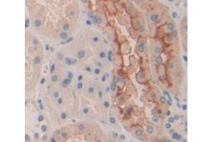 IHC-P analysis of Human Tissue, with DAB staining. (DOCK1 Antikörper  (AA 1200-1435))