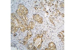 anti-C3 and PZP-Like, alpha-2-Macroglobulin Domain Containing 8 (CPAMD8) (AA 58-234) antibody