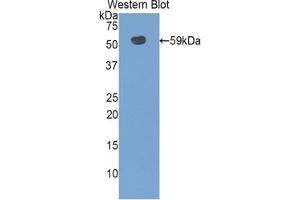 Detection of Recombinant SLC3A2, Rat using Polyclonal Antibody to Solute Carrier Family 3, Member 2 (SLC3A2) (SLC3A2 Antikörper  (AA 282-523))