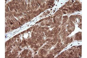 Image no. 7 for anti-Mitogen-Activated Protein Kinase 4 (MAPK4) antibody (ABIN1499312)