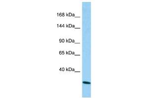 Host: Rabbit Target Name: CAPRIN2 Sample Type: A549 Whole Cell lysates Antibody Dilution: 1.