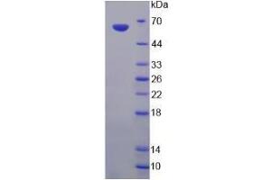 Image no. 1 for Endonuclease G (ENDOG) (AA 1-294) (Active) protein (His tag,GST tag) (ABIN6239837) (Endonuclease G Protein (ENDOG) (AA 1-294) (His tag,GST tag))