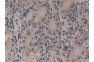 Immunohistochemistry (IHC) image for anti-Cold Inducible RNA Binding Protein (CIRBP) (AA 1-172) antibody (ABIN7442150)