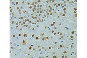 Immunohistochemistry of paraffin-embedded Mouse brain using MUS81 Polyclonal Antibody at dilution of 1:100 (40x lens). (MUS81 Antikörper)