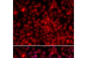 Immunofluorescence analysis of U2OS cells using ILF2 Polyclonal Antibody (ILF2 Antikörper)