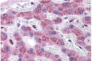 Human Liver: Formalin-Fixed, Paraffin-Embedded (FFPE) (Transmembrane Protein 18 (TMM18) (C-Term) Antikörper)