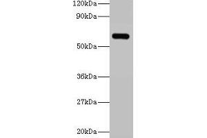 Western blot All lanes: YARS antibody at 2 μg/mL + 293T whole cell lysate Secondary Goat polyclonal to rabbit IgG at 1/15000 dilution Predicted band size: 60 kDa Observed band size: 60 kDa (YARS Antikörper  (AA 2-528))