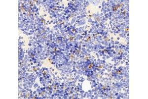 Immunohistochemistry analysis of paraffin-embedded mouse bone using,FCN1 (ABIN7073952) at dilution of 1: 3000 (FCN1 Antikörper)