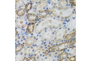 Immunohistochemistry of paraffin-embedded mouse kidney using CASP3 antibody (ABIN5997372) at dilution of 1/100 (40x lens).