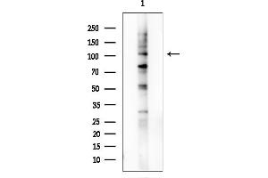 Western blot analysis of lysates from COLO205 cells, using RGAP1 Antibody at 1/1000 dilution.