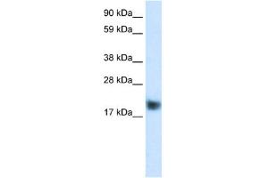 WB Suggested Anti-CSRP3 Antibody Titration:  0. (CSRP3 Antikörper  (C-Term))