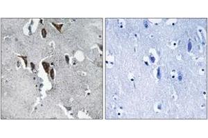 Immunohistochemistry analysis of paraffin-embedded human brain tissue, using ELOVL5 Antibody. (ELOVL5 Antikörper  (AA 250-299))
