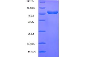 SDS-PAGE (SDS) image for VP40 (AA 1-303), (full length) protein (His-SUMO Tag) (ABIN5711355) (VP40 (AA 1-303), (full length) protein (His-SUMO Tag))