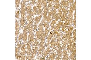 Immunohistochemistry (IHC) image for anti-Regulator of Calcineurin 1 (RCAN1) (AA 60-245) antibody (ABIN6146811)