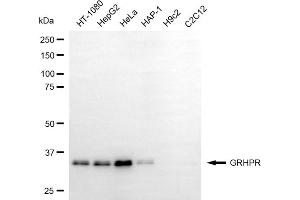 Western blotting analysis using GRHPR antibody (ABIN7798786). (GRHPR Antikörper)