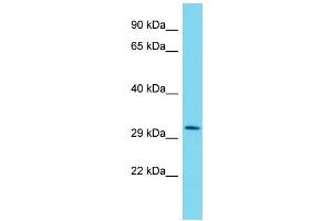 Western Blotting (WB) image for anti-Muscular LMNA-Interacting Protein (MLIP) (N-Term) antibody (ABIN2791247) (MLIP Antikörper  (N-Term))