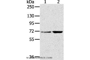 Western blot analysis of Hela and 293T cell, using SNX2 Polyclonal Antibody at dilution of 1:300 (Sorting Nexin 2 Antikörper)