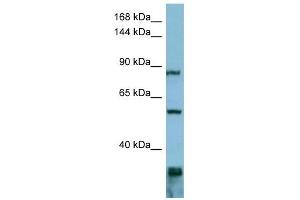 EPS8 antibody used at 1 ug/ml to detect target protein. (EPS8 Antikörper  (Middle Region))