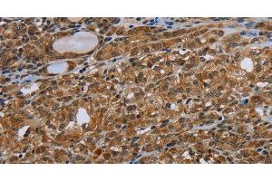 Immunohistochemistry (Paraffin-embedded Sections) (IHC (p)) image for anti-Ubiquitin-Like with PHD and Ring Finger Domains 2, E3 Ubiquitin Protein Ligase (UHRF2) antibody (ABIN7239260)