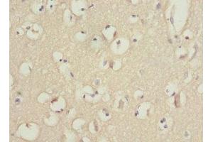 Immunohistochemistry of paraffin-embedded human brain tissue using ABIN7163172 at dilution of 1:100 (PIK3R3 Antikörper  (Regulatory Subunit Gamma))