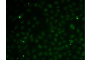 Immunofluorescence analysis of MCF7 cells using RC antibody (ABIN6132580, ABIN6146644, ABIN6146647 and ABIN6216132). (RAD51C Antikörper  (AA 1-135))