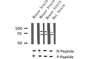 Western Blotting (WB) image for anti-Lamin A/C (LMNA) (pSer392) antibody (ABIN6256311)