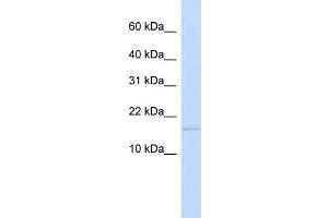 WB Suggested Anti-C3orf18 Antibody Titration:  0. (C3orf18 Antikörper  (N-Term))