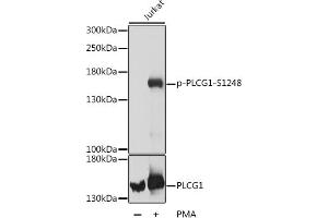 Western blot analysis of extracts of Jurkat cells, using Phospho-PLC gamma 1 (PLCG1)-S1248 antibody (ABIN7269347) at dilution or PLC gamma 1 (PLCG1) antibody . (Phospholipase C gamma 1 Antikörper  (pSer1248))