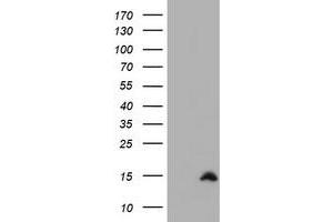Image no. 1 for anti-Cystatin SA (CST2) antibody (ABIN1497760) (CST2 Antikörper)