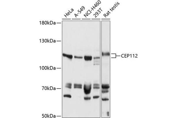CCDC46 antibody  (AA 1-240)