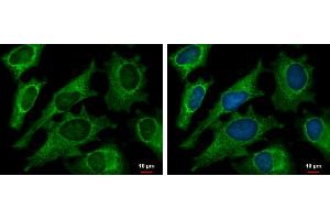 Immunofluorescence (IF) image for anti-2,4-Dienoyl CoA Reductase 1, Mitochondrial (DECR1) antibody (ABIN2856693)