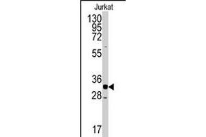 Western blot analysis of CDK2 polyclonal antibody  in Jurkat cell line lysates (35 ug/lane). (CDK2 Antikörper  (C-Term))