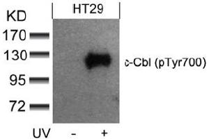 Image no. 3 for anti-Cas-Br-M (Murine) Ecotropic Retroviral Transforming Sequence (CBL) (pTyr700) antibody (ABIN319293) (CBL Antikörper  (pTyr700))