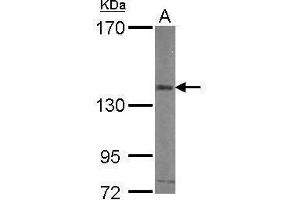 WB Image Sample (30 ug of whole cell lysate) A: HUVEC 7. (CD51 Antikörper  (C-Term))