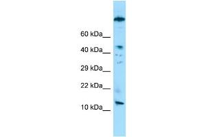 WB Suggested Anti-VCY Antibody Titration: 1.