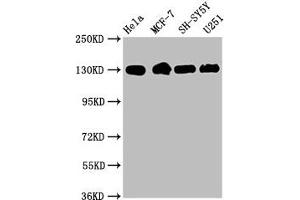 Western Blot Positive WB detected in: Hela whole cell lysate, MCF-7 whole cell lysate, SH-SY5Y whole cell lysate, U251 whole cell lysate All lanes: Integrin beta-1/CD29 antibody at 1. (Rekombinanter ITGB1 Antikörper)