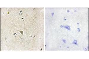 Immunohistochemistry analysis of paraffin-embedded human brain tissue, using LRRK1 Antibody. (LRRK1 Antikörper  (AA 361-410))