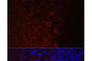 Immunofluorescence analysis of Rat brain using NEFH Polyclonal Antibody at dilution of 1:100. (NEFH Antikörper)