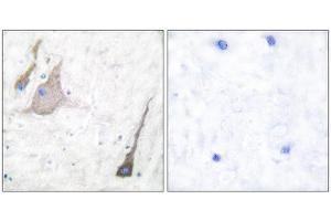 Immunohistochemistry (IHC) image for anti-Synuclein (SYU) (N-Term), (pan) antibody (ABIN1848790) (Synuclein Antikörper  (N-Term, pan))