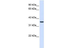 WB Suggested Anti-TXNDC14 Antibody Titration:  0. (TMX2 Antikörper  (Middle Region))