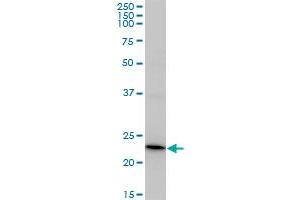 Recoverin Antikörper  (AA 1-200)