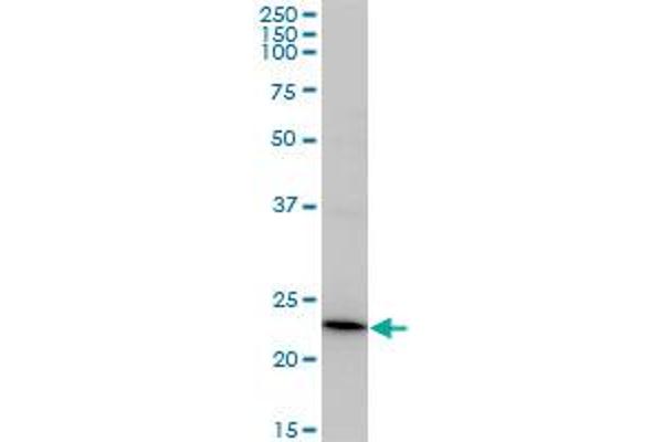 Recoverin Antikörper  (AA 1-200)