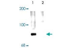 Western blot of rat cortex lysate showing specific labeling of the ~78k Syn1 protein phosphorylated at Ser 62,67 (Control). (SYN1 Antikörper  (pSer62, pSer67))