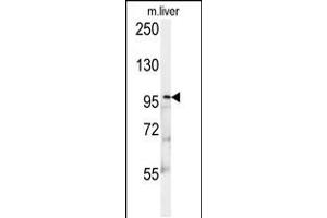Western blot analysis in mouse liver tissue lysates (15ug/lane). (KIF9 Antikörper  (C-Term))