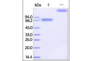 SDS-PAGE (SDS) image for Interleukin 21 Receptor (IL21R) (AA 20-236) (Active) protein (Fc Tag) (ABIN2181374) (IL21 Receptor Protein (AA 20-236) (Fc Tag))