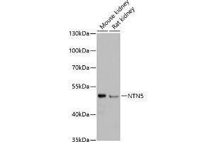 Western blot analysis of extracts of various cell lines, using NTN5 antibody (ABIN6132148, ABIN6144903, ABIN6144904 and ABIN6217109) at 1:3000 dilution. (Netrin 5 Antikörper  (AA 340-489))
