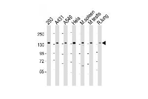 Western Blot at 1:2000 dilution Lane 1: 293 whole cell lysate Lane 2: A431 whole cell lysate Lane 3: A549 whole cell lysate Lane 4: Hela whole cell lysate Lane 5: mouse spleen lysate Lane 6: mouse testis lysate Lane 7: rat lung lysate Lysates/proteins at 20 ug per lane.