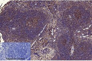 Immunohistochemical analysis of paraffin-embedded mouse spleen tissue. (NF-kB p65 Antikörper  (acLys310))