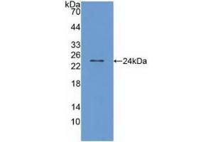 Detection of Recombinant TRPV1, Human using Polyclonal Antibody to Transient Receptor Potential Cation Channel Subfamily V, Member 1 (TRPV1) (TRPV1 Antikörper  (AA 1-153))